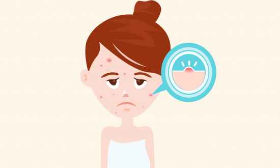 适合痤疮用的洗面奶