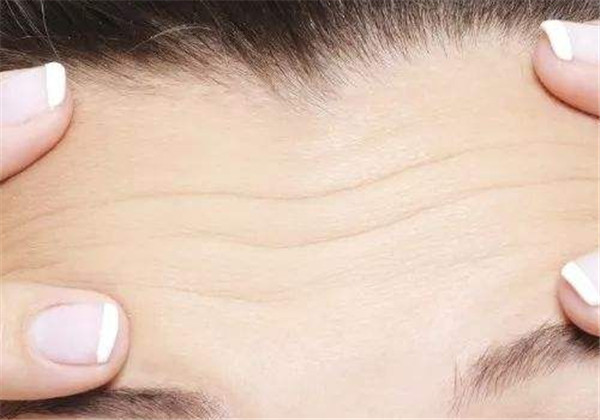 抬头纹太重怎么办，怎么预防