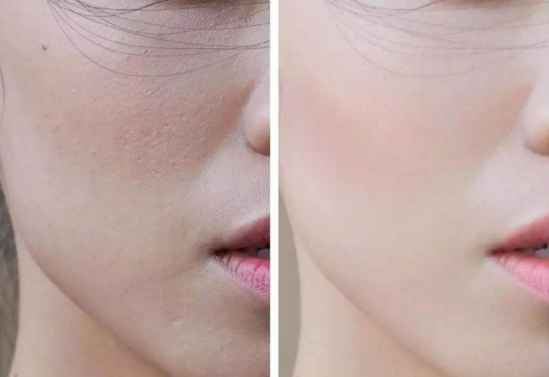 脸部皮肤粗糙，这样做就能改善