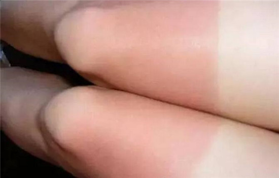 防晒和隔离哪个重要，护肤化妆都不能忘防晒