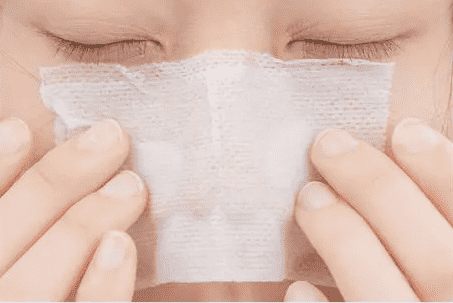 闭口怎么去除小妙招，简单实用的5个方法让粉刺消失