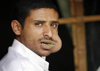 人为什么会变丑