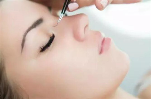 种睫毛眼皮过敏红肿痒怎么办，种睫毛眼皮肿了几天能好