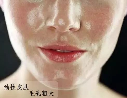 怎么判断自己什么肤质，自己的肤质都没搞清还怎么护肤