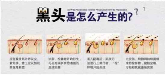 去黑头最有效的产品，去黑头这三步就够了