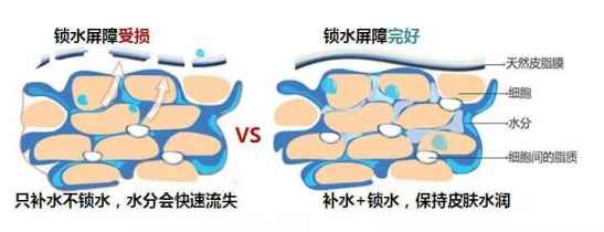 皮肤补水多了会怎么样，一味的补水反而害了皮肤