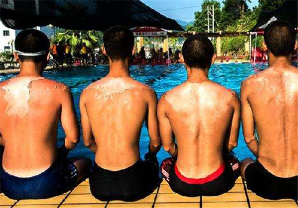 暴晒后皮肤发红怎么办，如何补救