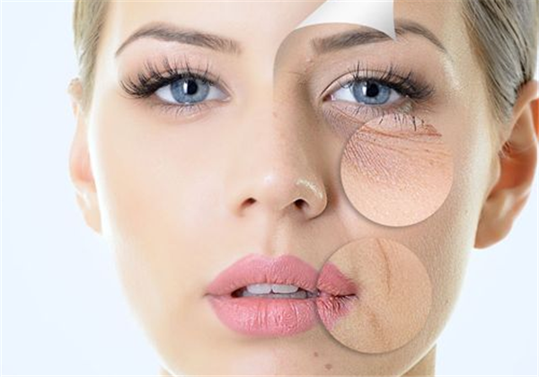 干性皮肤的特点，干性皮肤长斑怎么办