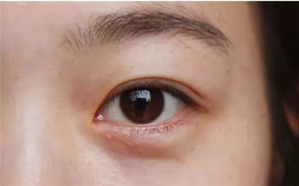 “眼霜”到底有没有用？深扒它的谎言和真相