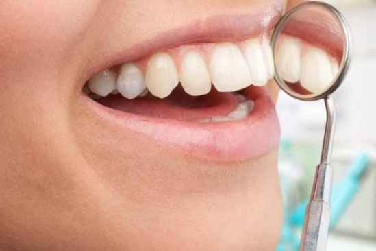 美白牙贴要贴多少分钟，美白牙贴要天天用吗