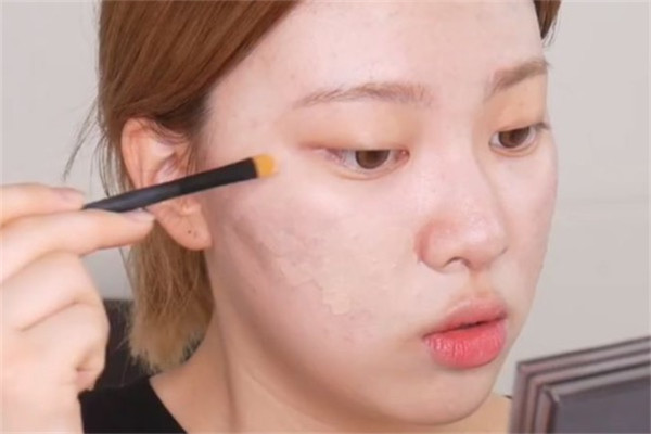 痘印怎么遮瑕