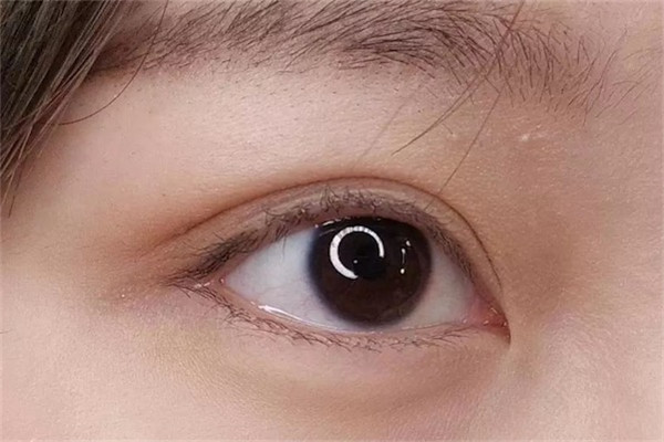 葡萄眼是什么眼型
