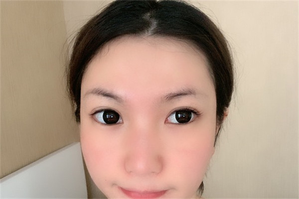 线雕几天可以洗头