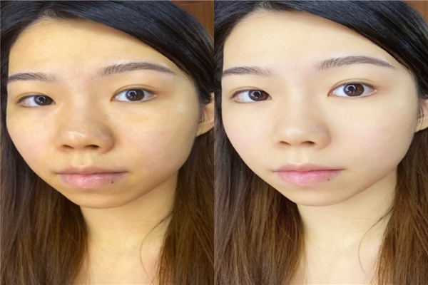 肤色暗黄是怎么回事，怎样提亮肤色改善暗黄