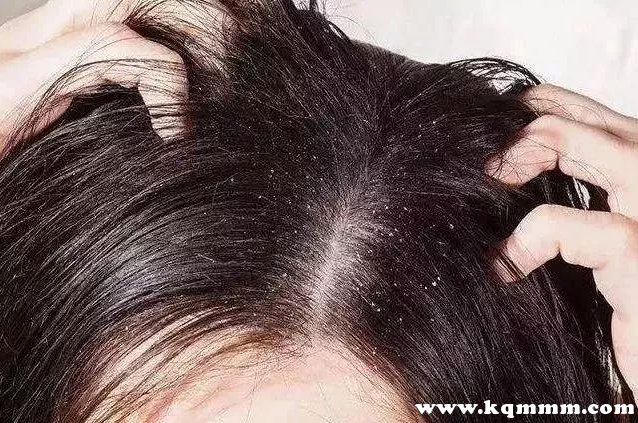 控油去屑止痒洗发水哪款好最新推荐，哪款洗发水控油效果最好