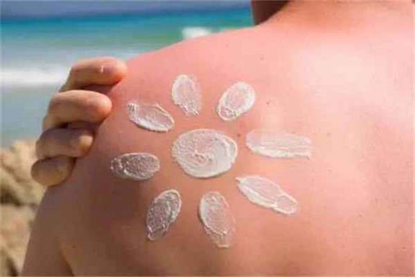 皮肤晒褪皮怎么办，皮肤晒过之后怎处理