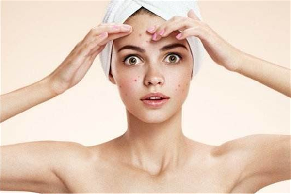 色斑的分类，去除色斑的护肤品