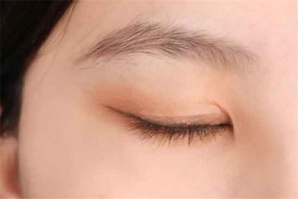 肿泡眼贴什么双眼皮贴好，肿泡眼适合什么样的双眼皮贴