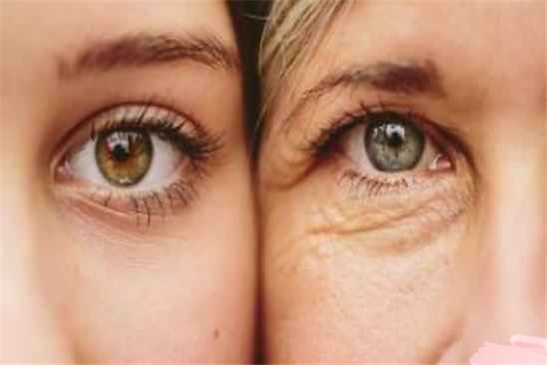 女人脸部显老的特点，最显老的部分有什么
