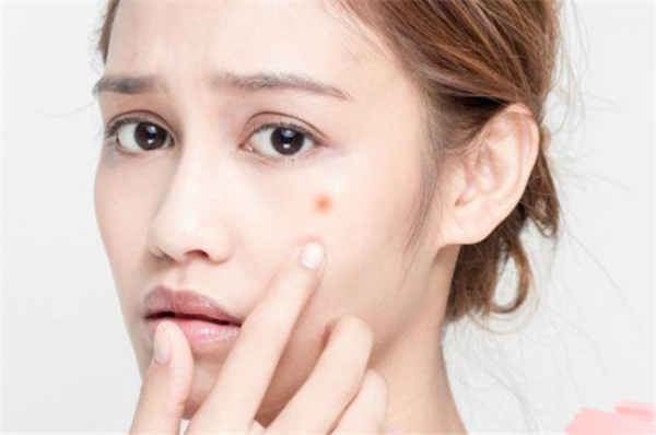 敏感肌怎么选择口罩，皮肤敏感的各种症状