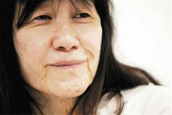 脸部松弛下垂怎么办，脸部松弛下垂有法令纹怎么办