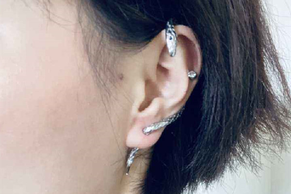 打耳骨怎么预防增生，打耳骨增生了怎么办