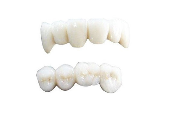 烤瓷牙会对原来的牙齿有影响吗，烤瓷牙的利弊