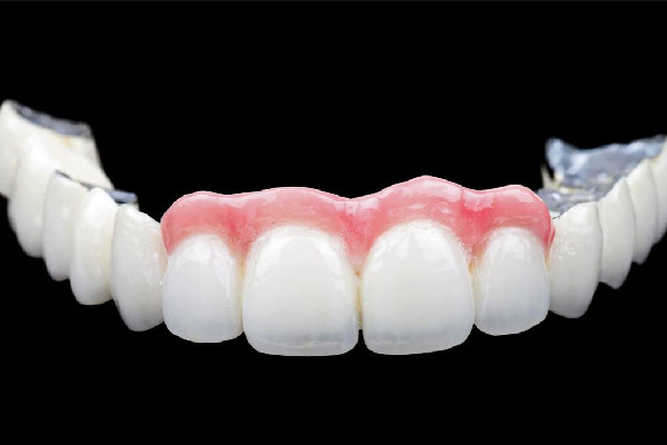 烤瓷牙的材料有几种，烤瓷牙用什么胶粘最好