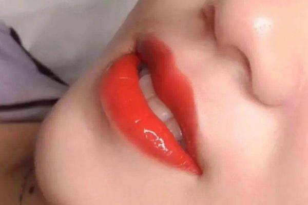 纹唇几天能恢复好，纹唇几天消肿