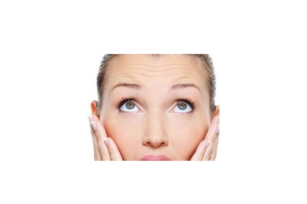 抬头纹是怎样形成的，抬头纹可以去除吗