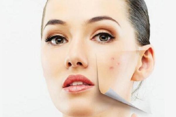 痘痘肌肤要涂防晒吗，痘痘肌是先补水还是先祛痘