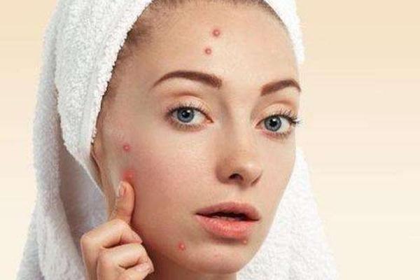 痘痘肌肤怎么修复，痘痘肌肤适合用什么牌子的护肤品
