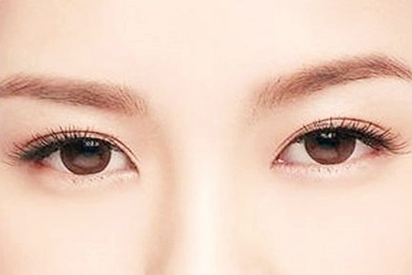 双眼皮埋线会留疤吗，双眼皮埋线会增生吗