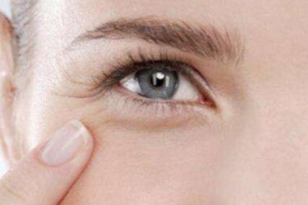 鱼尾纹怎么才能去掉，鱼尾纹是哪个部位