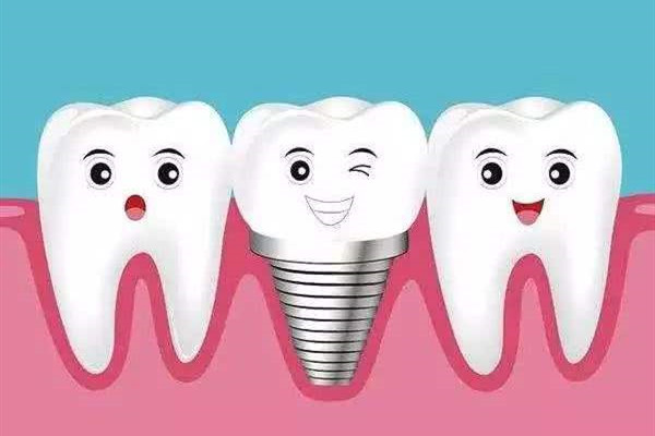 种牙多少钱一颗啊，种牙需要多少时间