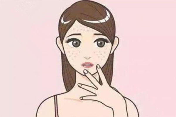 黄褐斑能用药水点掉吗，黄褐斑能用射频美容仪吗