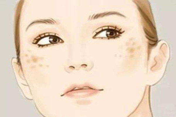 黄褐斑敷面膜有用吗，黄褐斑敷什么面膜好