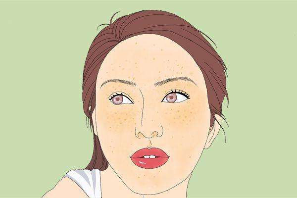 黄瓜敷脸能去黄褐斑吗，白醋洗脸可以去除黄褐斑吗