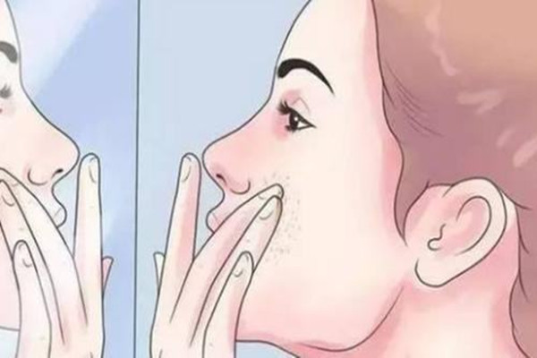 黄褐斑有几种类型，黄褐斑长在什么位置