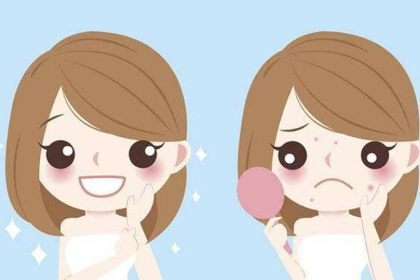 青春痘可以自愈吗，青春痘可以用洗面奶吗