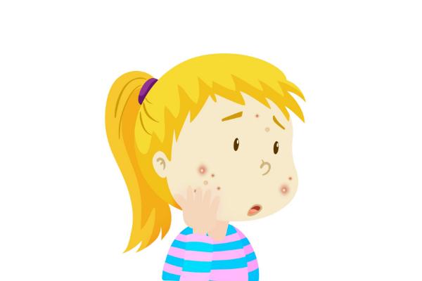 青春痘的原因是什么，青春痘的痘印怎么消除