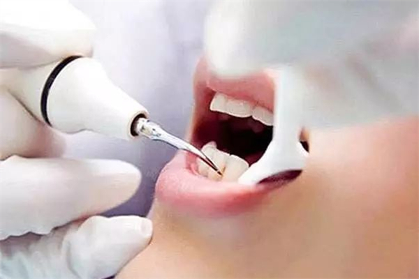 洗牙对牙齿有什么影响，洗牙可以除口臭吗