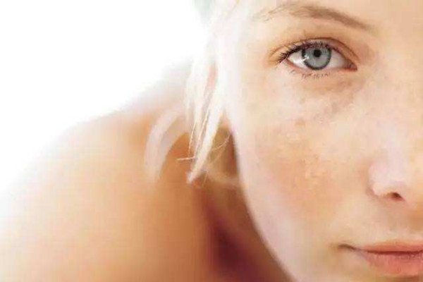 晒斑可以自然消失吗，晒斑可以用激光去掉吗