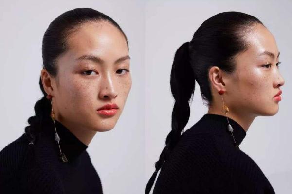 雀斑对身体有影响吗，雀斑可以做光子嫩肤吗