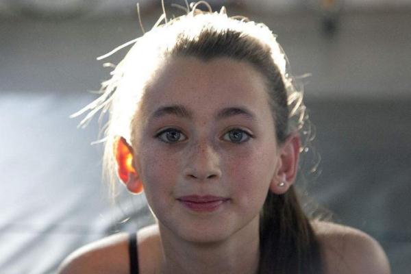 雀斑会变成黄褐斑吗，雀斑会一直长吗