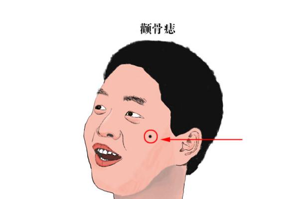 点痣对身体健康有影响吗，点痣对怀孕有影响吗