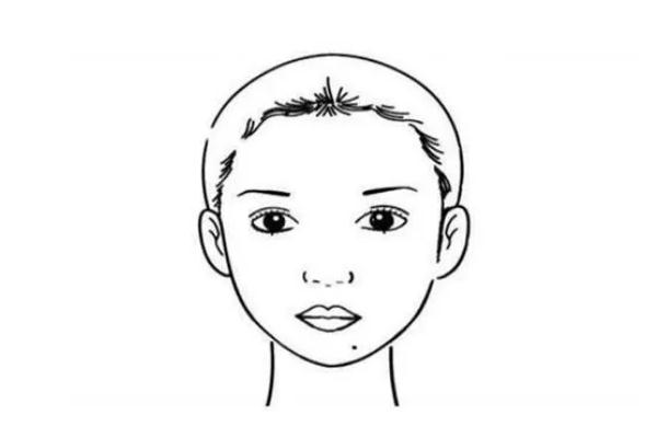 点痣会不会复发，点痣会留疤留坑吗