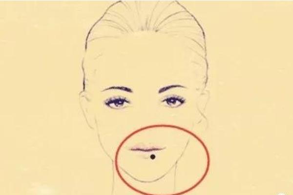 点痣是什么意思，点痣后要做好保护措施