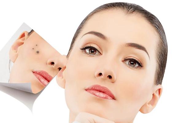 点痣去医院挂什么科，点痣后需要注意什么事项