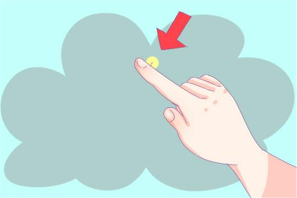 倒刺会自己掉吗，倒刺不处理会怎么样